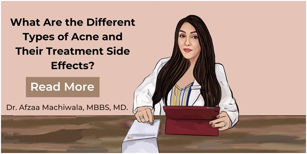 What Are The Different Types Of Acne And Their Treatment Side Effects?