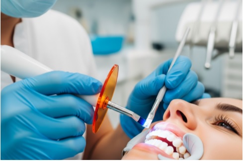 Common Myths About Teeth Whitening in Colorado Springs