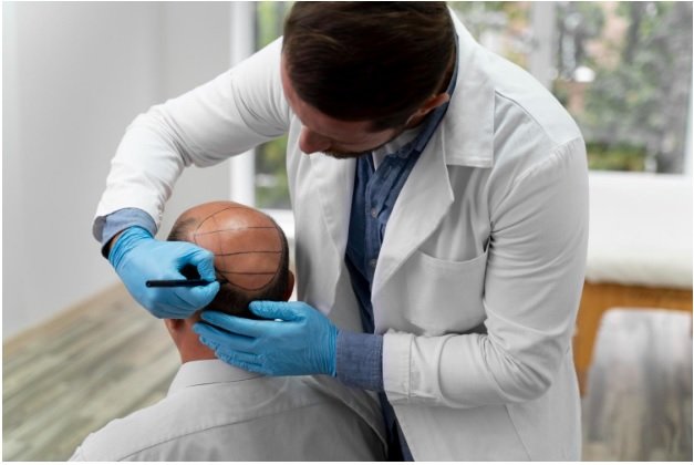Advanced FUE Techniques for Fuller, Natural-Looking Hair